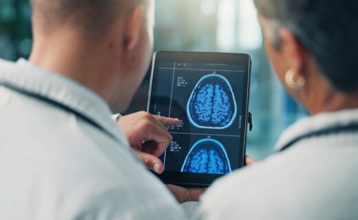 Fibrillazione atriale e declino cognitivo