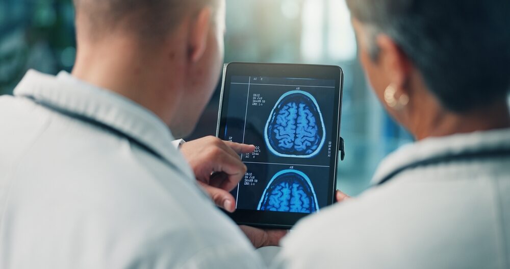 Fibrillazione atriale e declino cognitivo